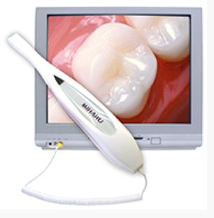 Photo of intraoral camera